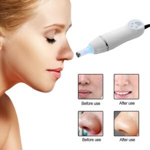 Electric Blackheads Remover